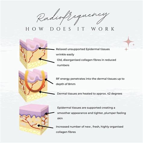 How does Radio Frequency (RF) Skin Tightening work? — Louisville ...