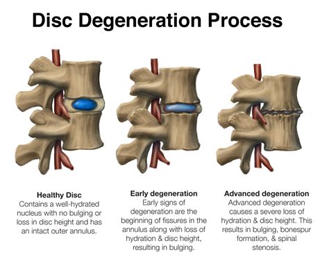 What's New in the Disc