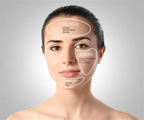 Acne Face Map: What Are Your Breakouts Telling You?