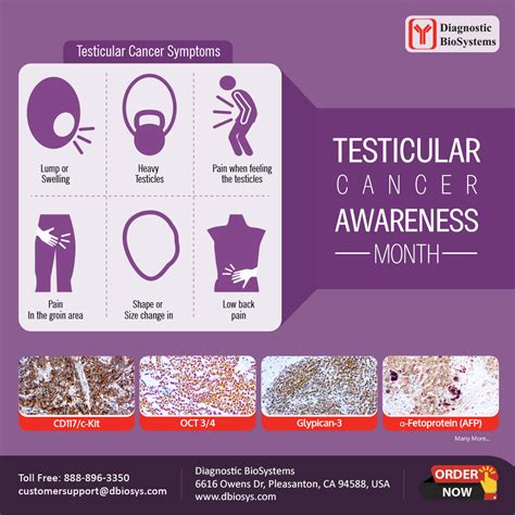 Testicular Cancer Awareness Month - Diagnostic BioSystems -Advanced Tissue Diagnostics & Trusted ...