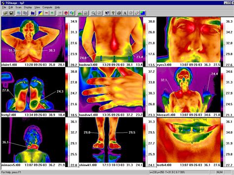 ThermReview Infrared Image Processing Software for Medical Thermal Imaging - IR cameras ...