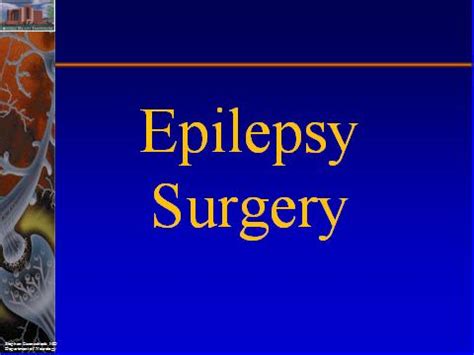 Epilepsy Surgery » Department of Neurology » College of Medicine » University of Florida