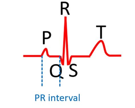 What are the normal values for ECG measurements? – All About Heart And Blood Vessels