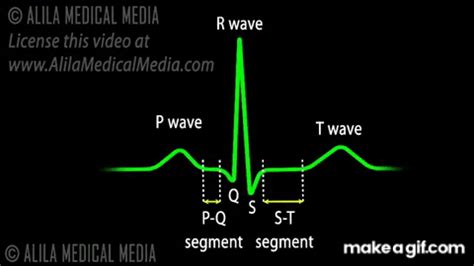 Cardiac Conduction System and Understanding ECG, Animation. on Make a GIF