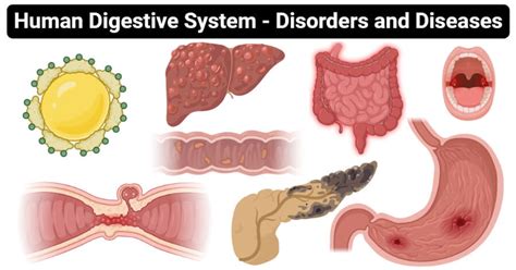 Disorders and Diseases of the Human Digestive System