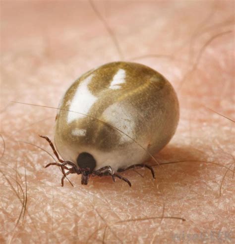 How to remove a tick from your pet - Animed Direct