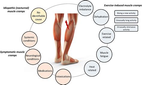 What Causes Muscle Contractures