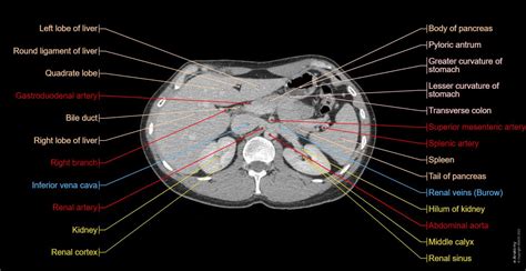 Normal Ct Scan Abdomen/pelvis