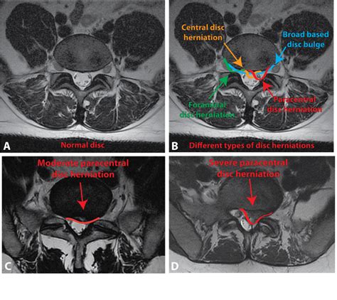 %%sitename%% %%title%% in 2023 | Radiology imaging, Mri, Magnetic resonance imaging