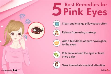 Quick Home Remedies for Conjunctivitis (pink eye) - By Dr. Anil Kumar ...