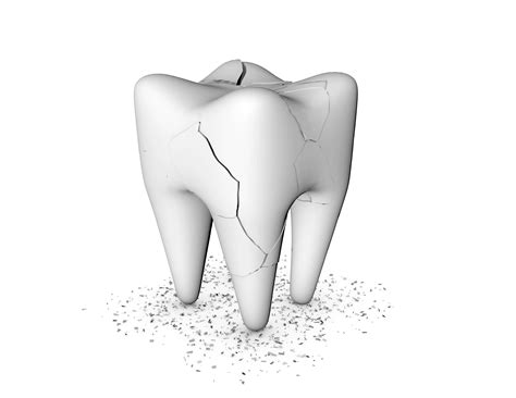 What to do with cracked tooth under the crown of root canal