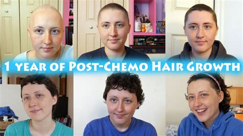 Chemotherapy Hair Loss Timeline