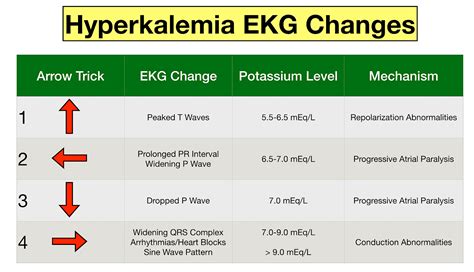 Hyperkalemia Ekg