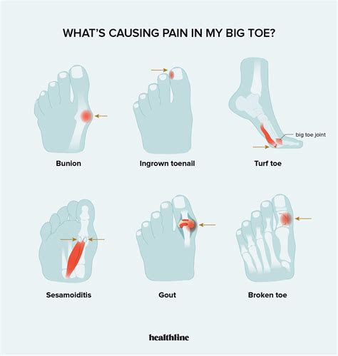 Causes of Sharp Pain in Big Toe and When to Contact a Doctor