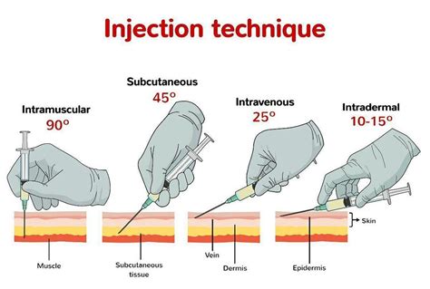 Medical Doctors Worldwide on Instagram: “Different types of injection: - Intramuscular ...