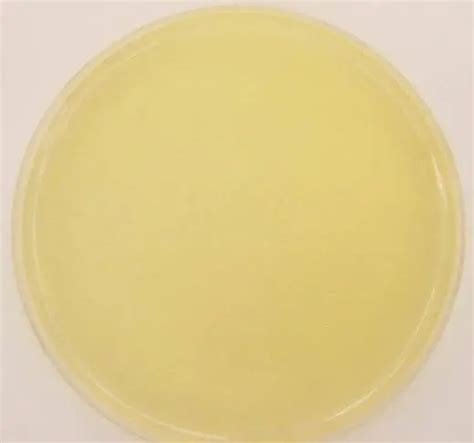 Nutrient Agar: composition, preparation and uses - microbeonline