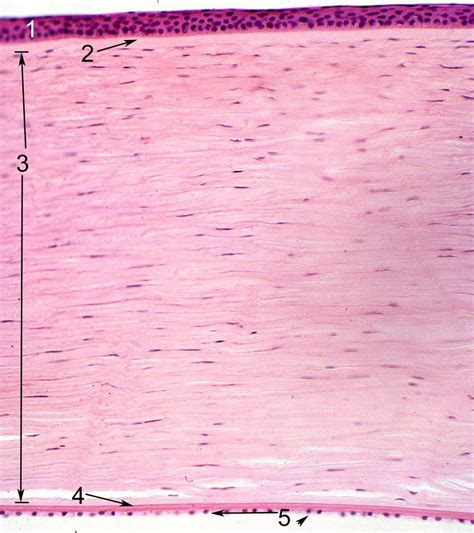 ANATOMY OF THE HUMAN EYE: Cornea Histology