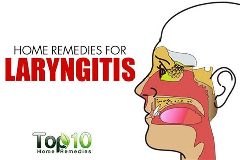 Home Remedies for Laryngitis | Top 10 Home Remedies