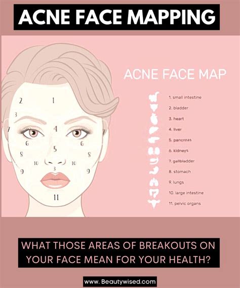 Acne face map: What does acne pimples on your cheeks, forehead, jawline,T-zone, left cheek,etc ...