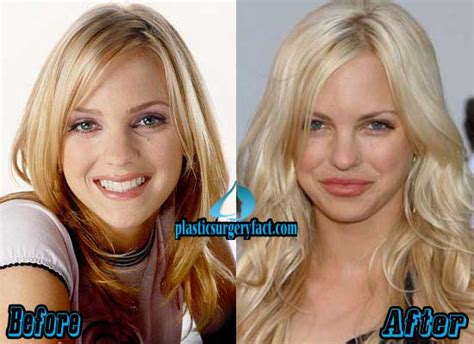 Anna Faris Plastic Surgery Before and After Photos