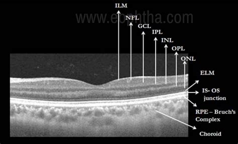 Retinal Layers Oct