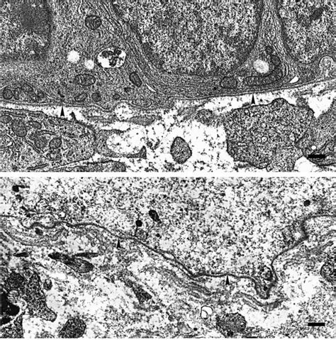 Electron micrograph of basal lamina from antral atretic bovine... | Download Scientific Diagram