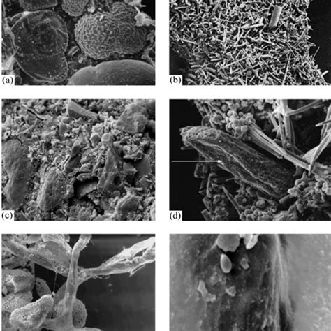 Xenophyophores from the Clarion-Clipperton nodule field: (a)... | Download Scientific Diagram