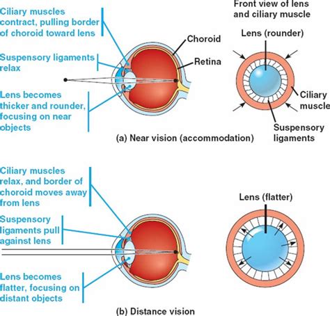 Miosis definition, causes, symptoms, diagnosis & treatment