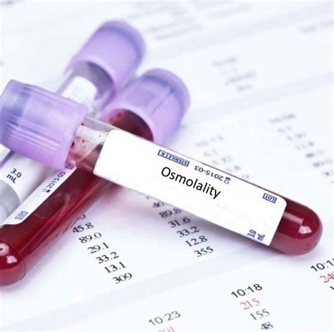 Osmolality, serum osmolality, urine osmolality, normal range & equation