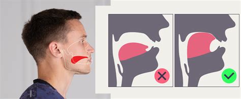 Where Should Your Tongue Rest? Proper Tongue Position Explained ...