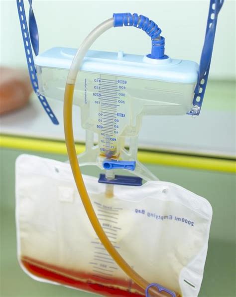 What Are the Different Catheter Types? (with pictures)