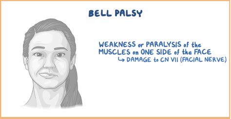 Clinical: NCLEX® QOTD: Bell's Palsy