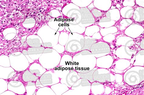 Rat. Unilocular adipose tissue. Transverse section. 250X - Unilocular ...