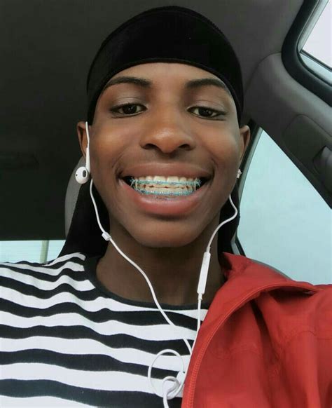 Cute Braces Colors For Dark Skin – Warehouse of Ideas