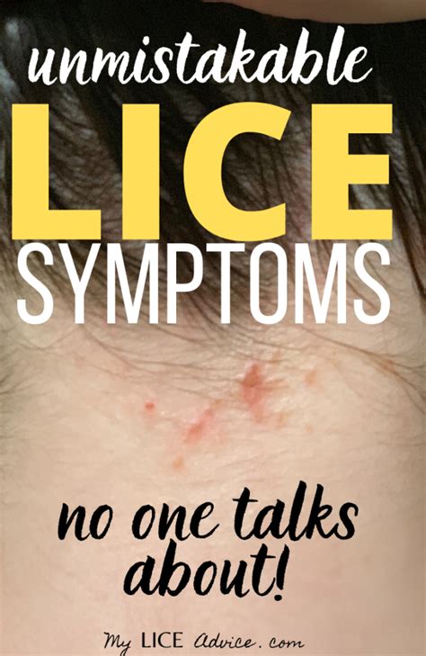 17 Lice Symptoms with Pictures: Signs That You Have Head Lice - My Lice Advice