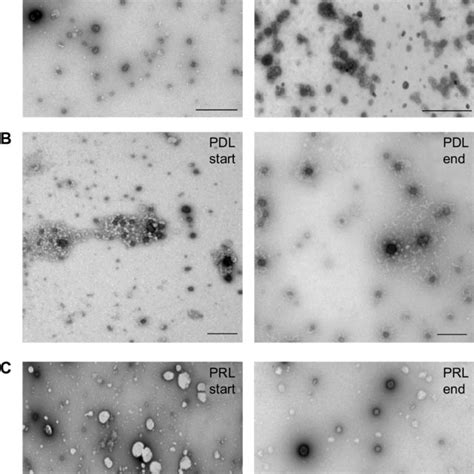 Electron microscopy of nanocomplexes. Notes: Negative staining... | Download Scientific Diagram