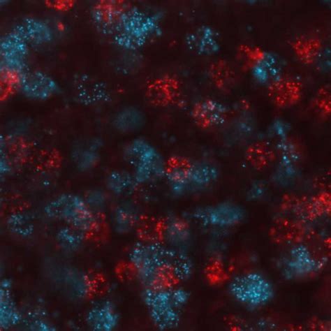 Fluorescence In Situ Hybridization (FISH - RNAscope) in mouse brain sections