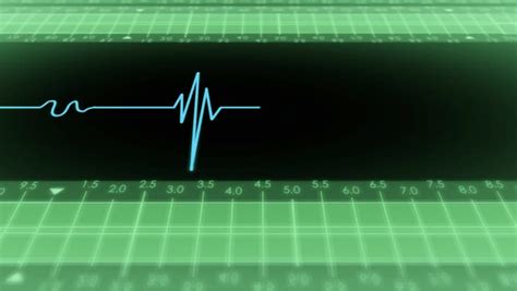 Animation Of An Electrocardiography (ECG) Showing Pulsating Hearth Beat ...