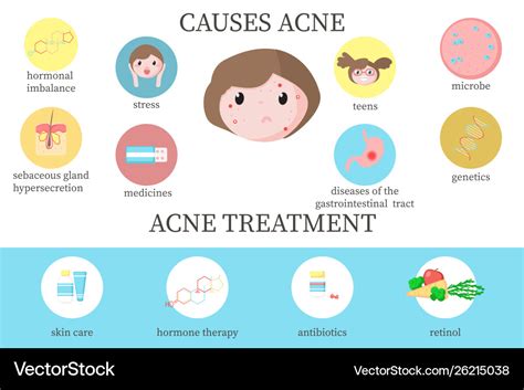 Acne Causes And Treatment Diagram Vector Flat Illustration | The Best ...