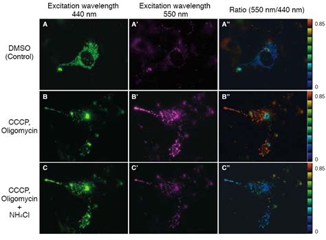 Investigating Parkinson's Disease Part I: Mitophagy & How to Visualize It