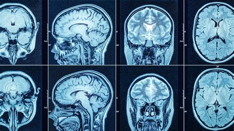 12 Reasons You May Need a CT Scan - Lompoc Valley Medical Center