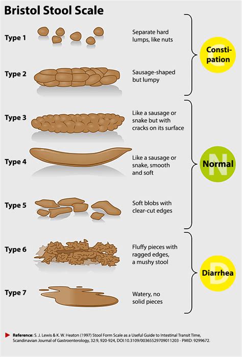 Bristol Stool Chart Tool For Faeces Type Classification Vector ...