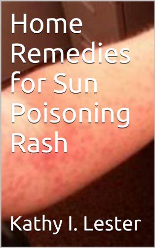 Home Remedies for Sun Poisoning Rash eBook : Lester, Kathy I.: Amazon.ca: Kindle Store