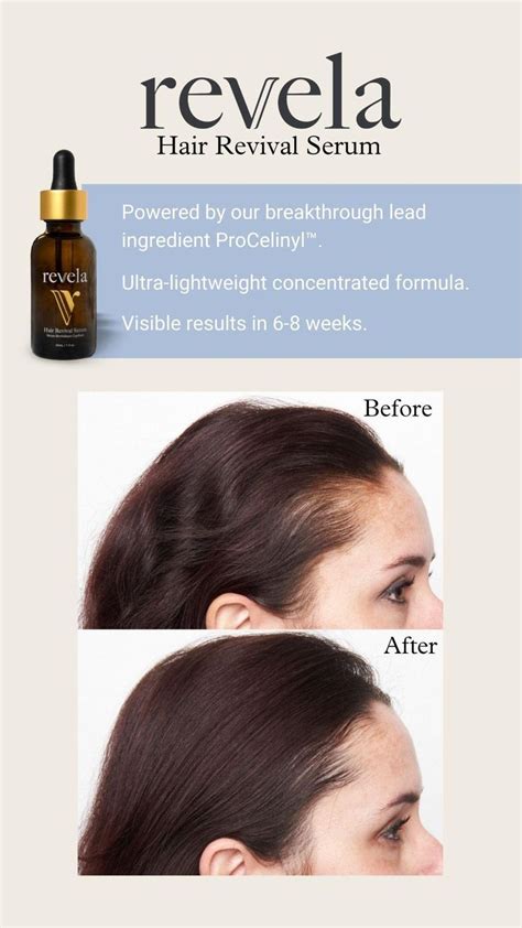 Revela Hair Revival Serum Before and After