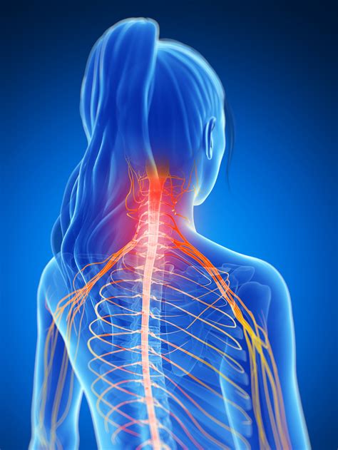 Neck & Upper Back Pain — Outline Health | Osteopath Farnham | Osteopath Odiham