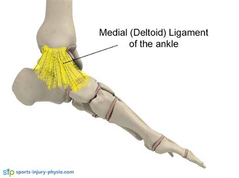 Ankle Sprains Diagnosis | Sports Injury Physio