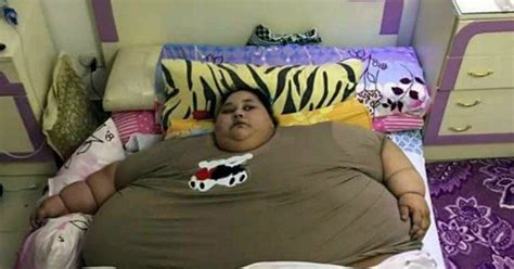 World’s fattest woman set to lose 62st after weight-loss surgery - Daily Star