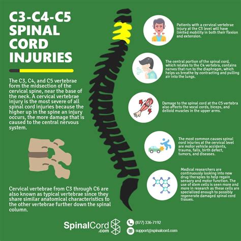 C3, C4, & C5 Vertebrae Spinal Cord Injury | SpinalCord.com