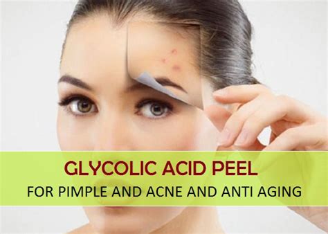 Homemade Glycolic Acid Peel for pimple, Acne, Anti aging