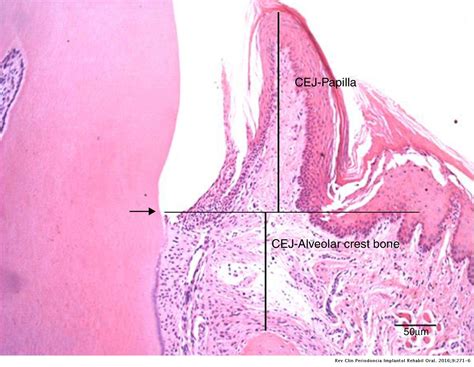 Mucogingival Junction Histology